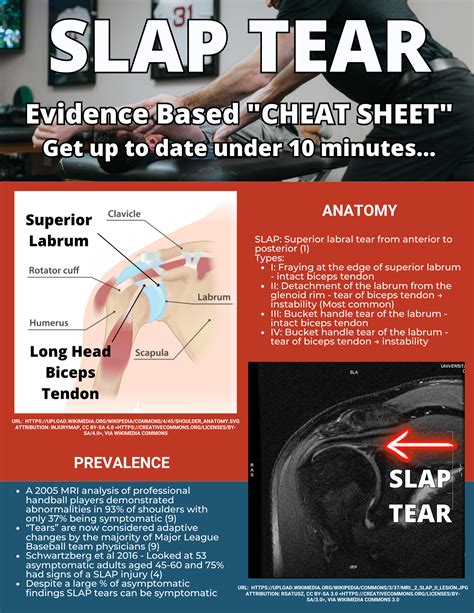 slapsgiving episodes|diagnosing a slap tear.